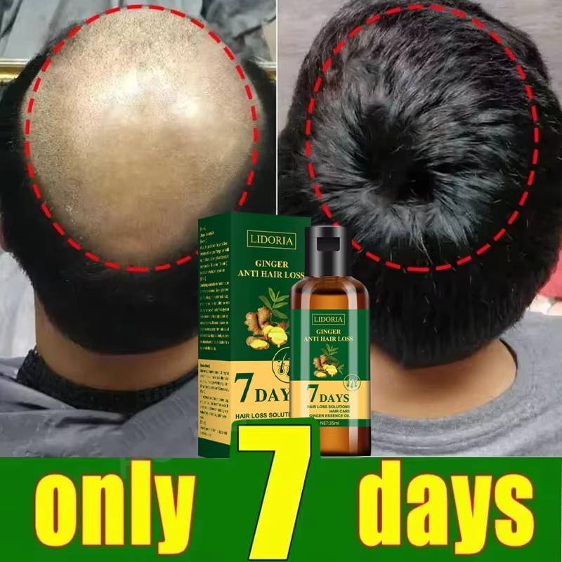 Serum Penumbuh Rambut 7 Hari P - Epidermal Growth Factor ulasan dan harga